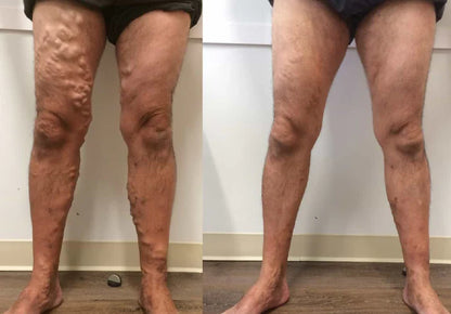 Soulagez Les Douleurs, Améliorez La circulation Et Rendez Votre Peau Douce Avec South Moon